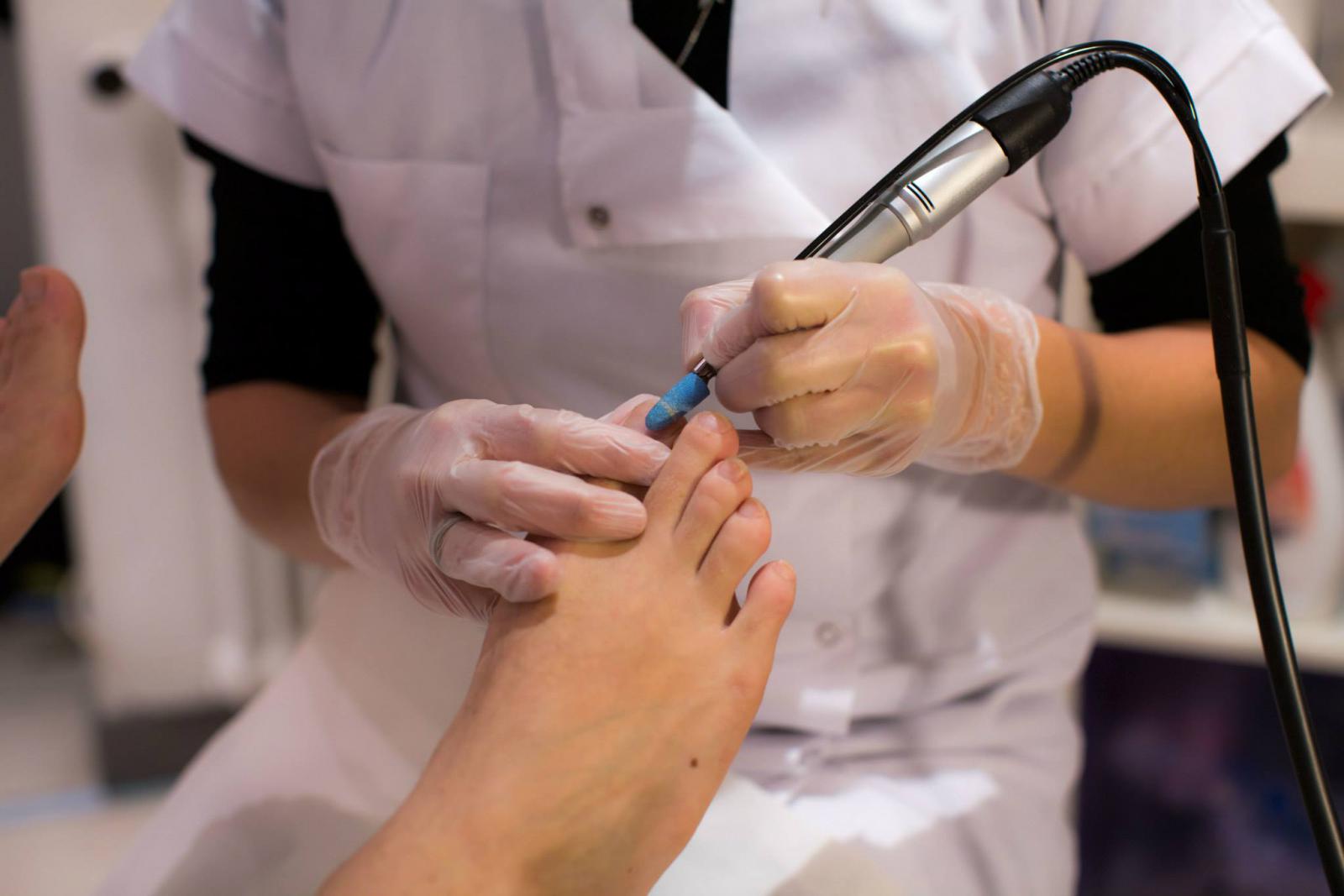 Tırnak ve Ayak Mantarları